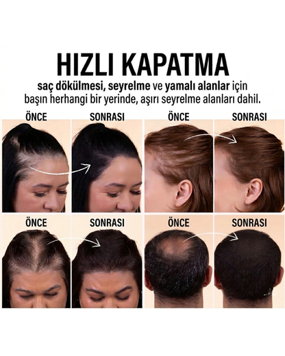 Acasyn Saç Kapatıcı Tozu